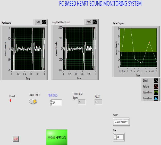 This signal can be recorded using AUDACITY software and can be stored as a dataset. This software records the heart sound and displays it when required.