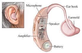 Hearing Loss/Disruptions Conduction hearing loss: Problems with the mechanical system (outer ear/middle ear) that result in the conduction of the sound waves.