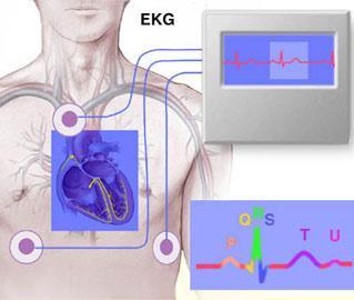3-CHANEL ECG 12-CHANEL ECG Heart