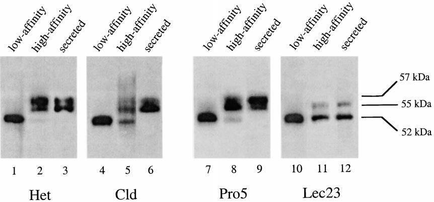 The bottom figures show LPL mass detected by Western blot analysis of equal volumes from fractions 2 5 (low-affinity LPL) and 13 16 (high-affinity LPL). A: Elution profile of Het and Cld cells.