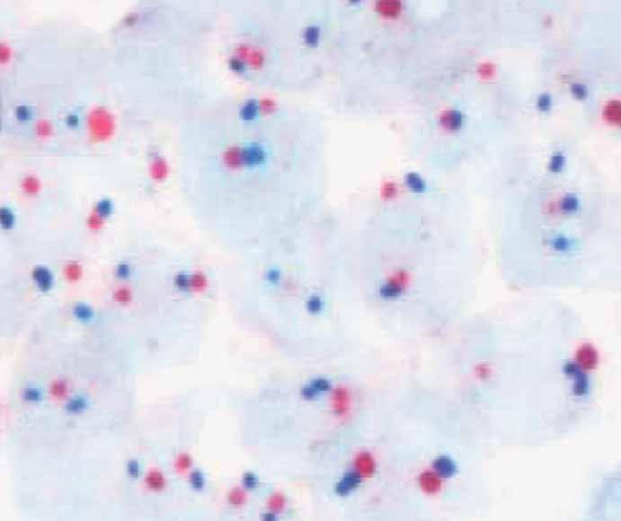 Valentino et al / MYC Signal Clusters in Lymphoma A B C D E Image 1 MYC