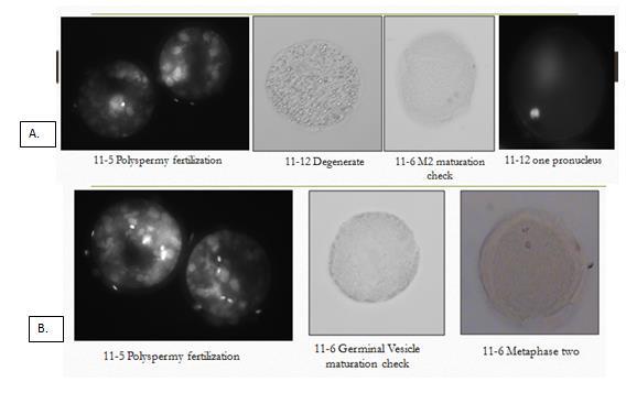 Results also demonstrated that some proportion of oocytes became matured (12.26% and 2.47%) after vitrification in both treatment groups and showed a significant difference the two (P=0.