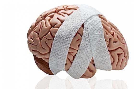 I. Concussions A concussion is a brain injury that: Is caused by a bump, blow, or jolt to the head or body Can change the way your brain normally works