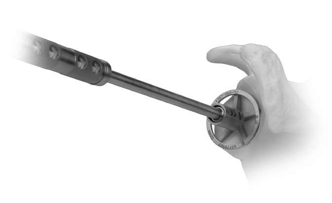 9). Slip the reamer over the central pin and ream to the desired depth or correction (Fig. 10 and 11). Fig. 10 Avoid wobbling the reamer to maintain alignment with the pin axis.