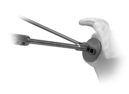 6 Trabecular Metal Glenoid Surgical Technique Next, use the same size Trabecular Metal Glenoid A/P Drill Guide to drill the anterior and posterior holes (Fig. 17).