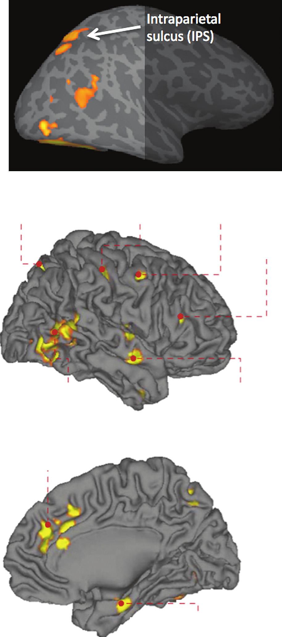 104 DISTRIBUTED NEURAL SYSTEMS FOR FACE PERCEPTION (a) Superior parietal lobule (b) Postcentral sulcus Frontal eye field Inferior frontal cortex C6.F8 Fig. 6.
