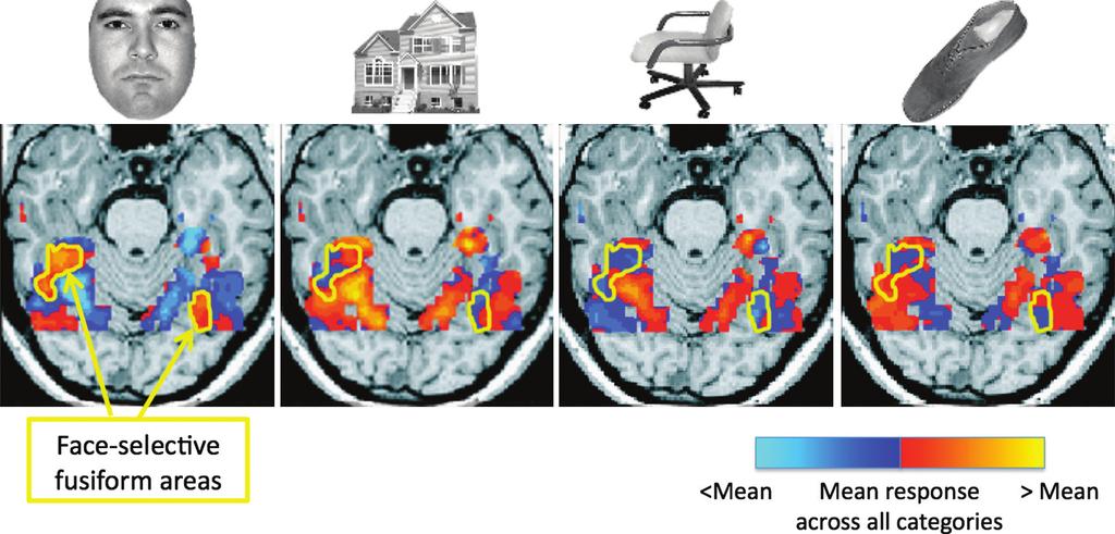 98 DISTRIBUTED NEURAL SYSTEMS FOR FACE PERCEPTION C6.F4 Fig. 6.4 Patterns of response in ventral temporal cortex to faces and three categories of objects houses, chairs, and shoes.