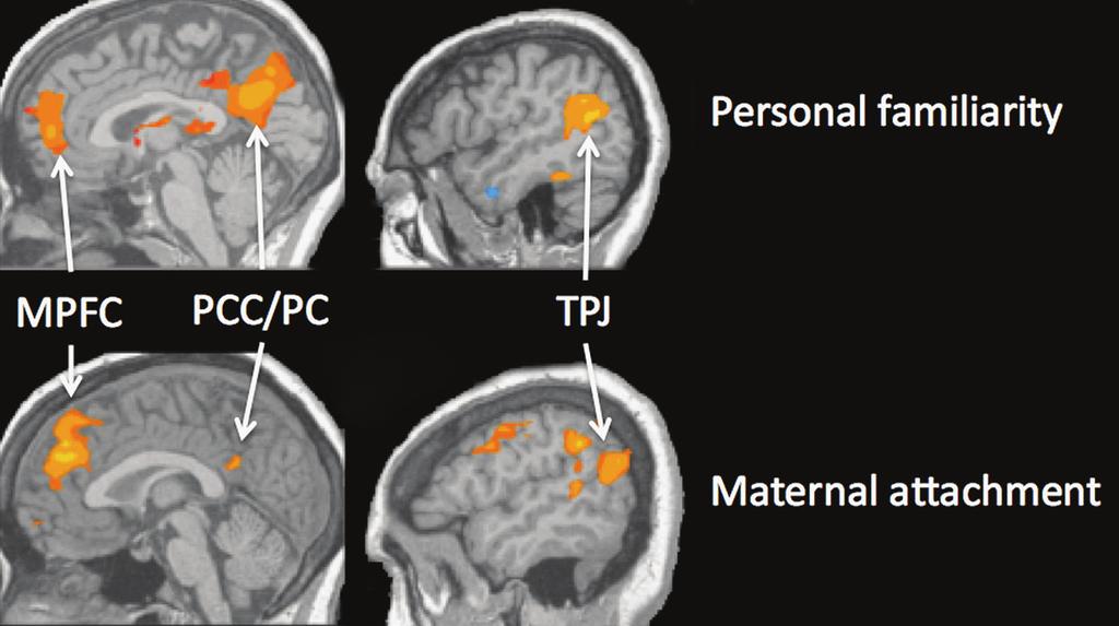 THE EXTENDED SYSTEM FOR EXTRACTING INFORMATION FROM FACES 99 and Freiwald and Tsao, Chapter 36, this volume) and other ventral temporal areas (e.g. anterior temporal cortex, Kriegeskorte et al.