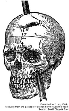 ! Chapter 14 Part 2 Brain/Cranial Phineas P. Gage - Prefrontal Lobotomy! 13! Functions of the Frontal Lobe 4! 4. Motor Speech (Broca s) Area! An association area! Connected to Wernicke s area!