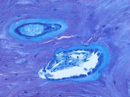 Cortical Bone Remodeling (different field) Slide 8. Cortical Bone Remodeling (different field) Toluidine Blue Stained (400x) Slide 7.