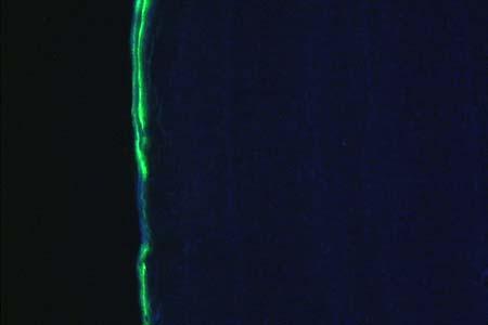 A section of monkey femoral midshaft cortical bone showing periosteal and intracortical labels as seen under fluorescence