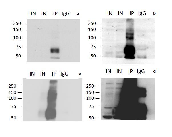 Supplementary Figure S5 Supplementary Figure S5: EBF1 and TET2 Western Blots a) Blot against EBF1; 1 min exposure to visualise IP and control.