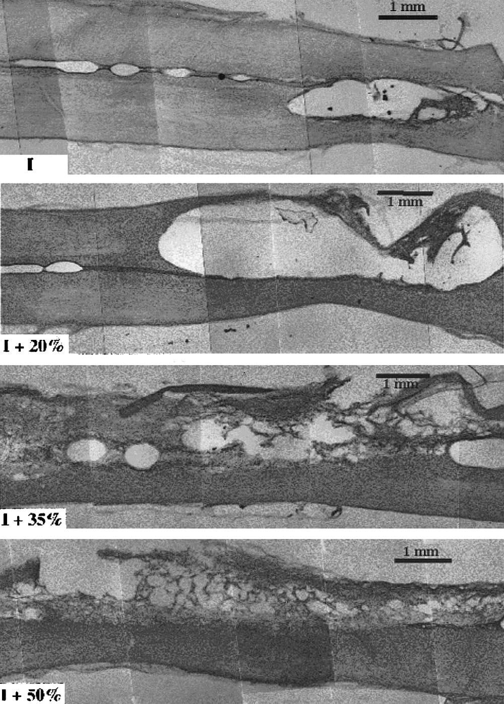 1630 Spine Volume 24 Number 16 1999 Figure 13. Histology: neurologic recovery versus canal narrowing.