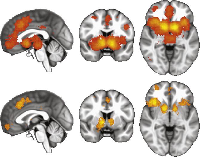 O. Bartra et al. / NeuroImage 76 (2013) 412 427 425 investigation relies heavily on discriminating positive and negative responses (see, e.g., Fig. 3).