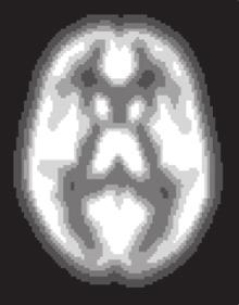 416 O. Bartra et al. / NeuroImage 76 (2013) 412 427 A Foci per cm 3 3 2 1 0 0 0.07 0.28 0.48 0.63 0.96 GM probability (bin ceiling) Fig. 2. Effect of gray-matter probability (pgm) on the density of reported activation foci, across all results in our corpus.
