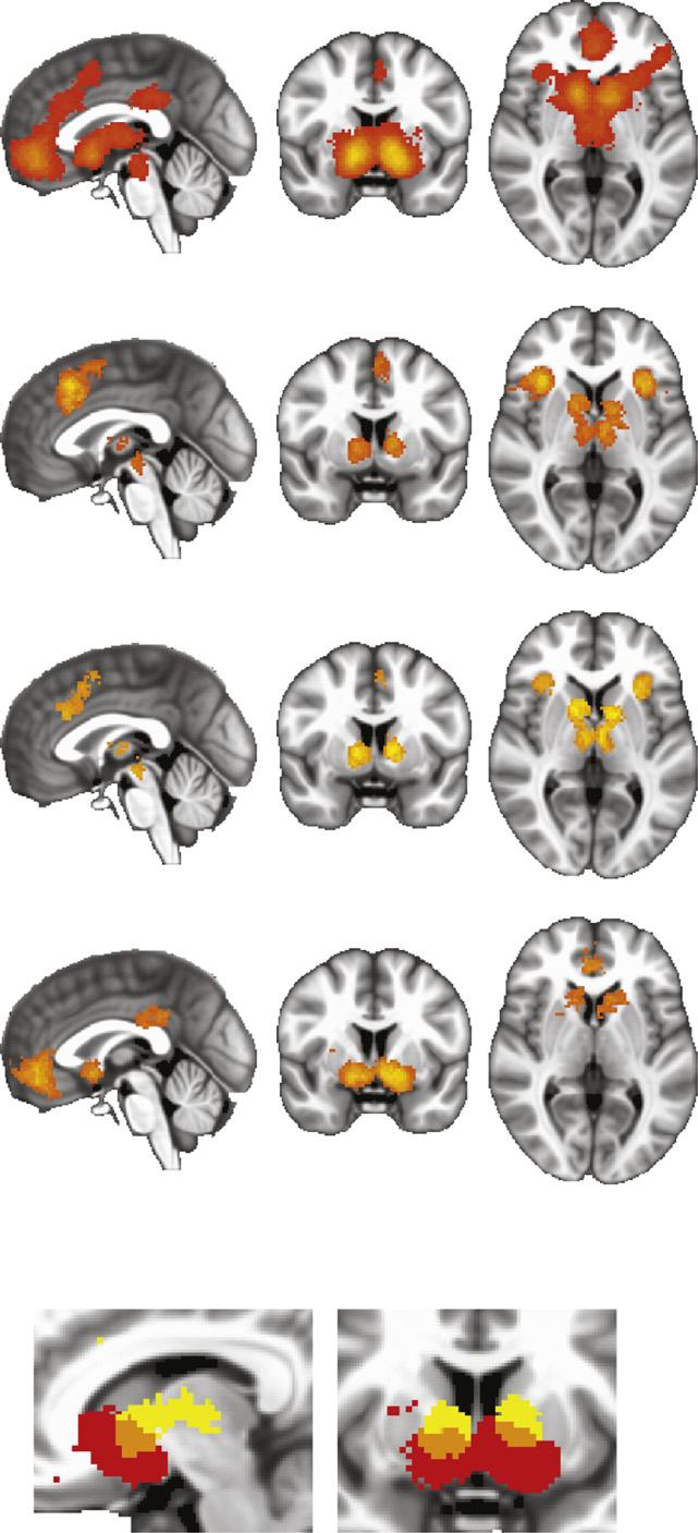 O. Bartra et al. / NeuroImage 76 (2013) 412 427 417 studies using a Wilcoxon signed-ranks test, and between categories of studies using Wilcoxon rank-sum tests.