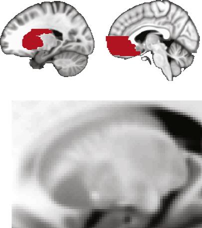 418 O. Bartra et al. / NeuroImage 76 (2013) 412 427 Table 1 SV effects.