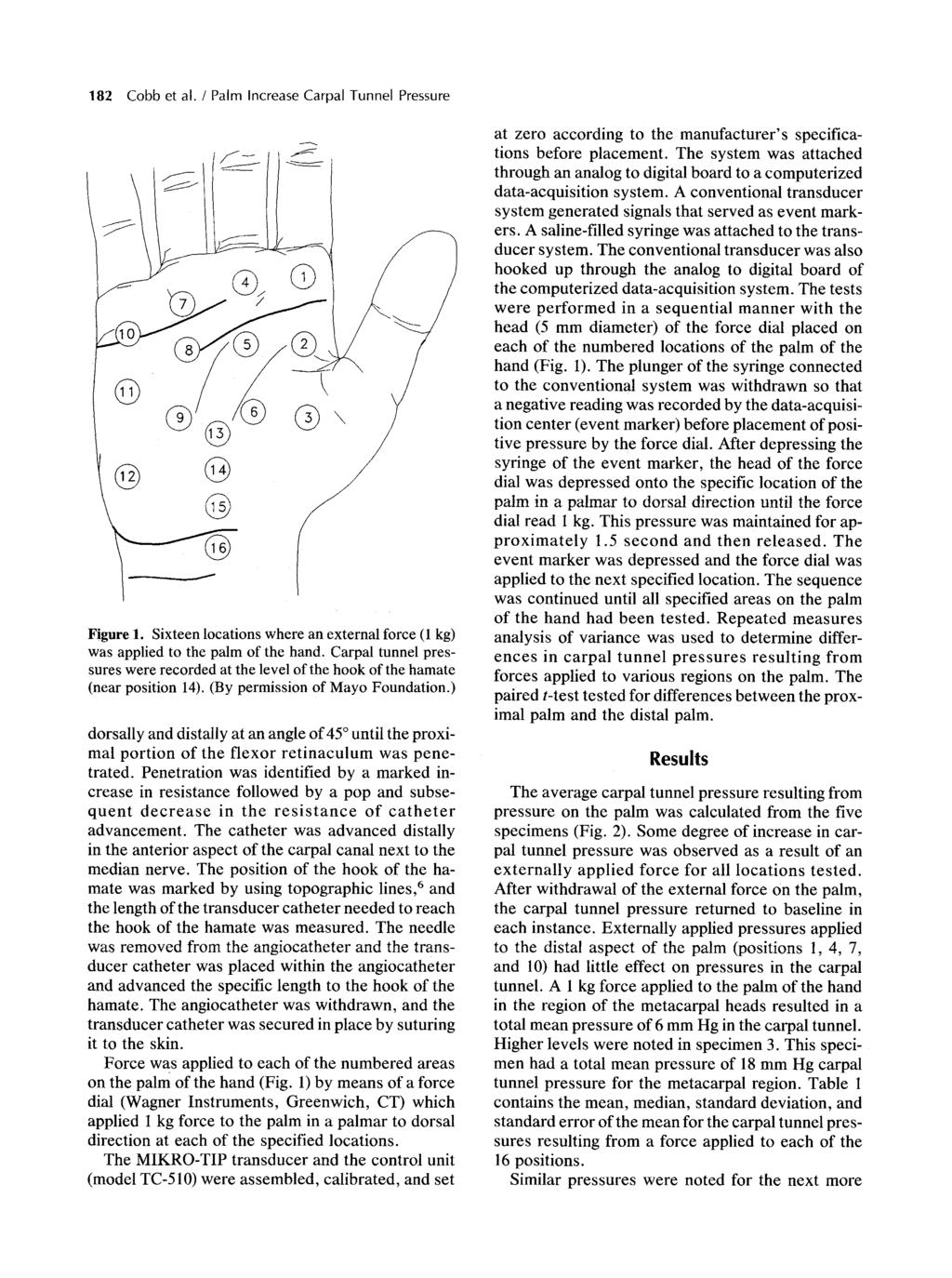 182 Cobb et al. / Palm Increase Carpal Tunnel Pressure 9 @ @ / Figure 1. Sixteen locations where an external force (1 kg) was applied to the palm of the hand.