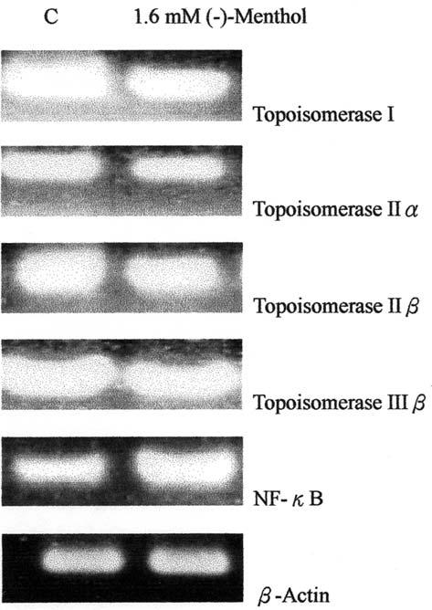 The cells were washed with PBS, total RNA was isolated and subjected to PCR for topoisomerase I, II, II and NF-Î B primers, as described in Materials and Methods. Table π.