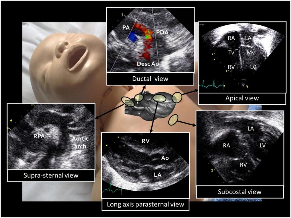 SECTION 1: ULTRASOUND CONCEPTS AND TECHNIQUES 2D methods Two dimensional imaging is the most common modality and is typically used to illustrate the structural anatomy of the heart.