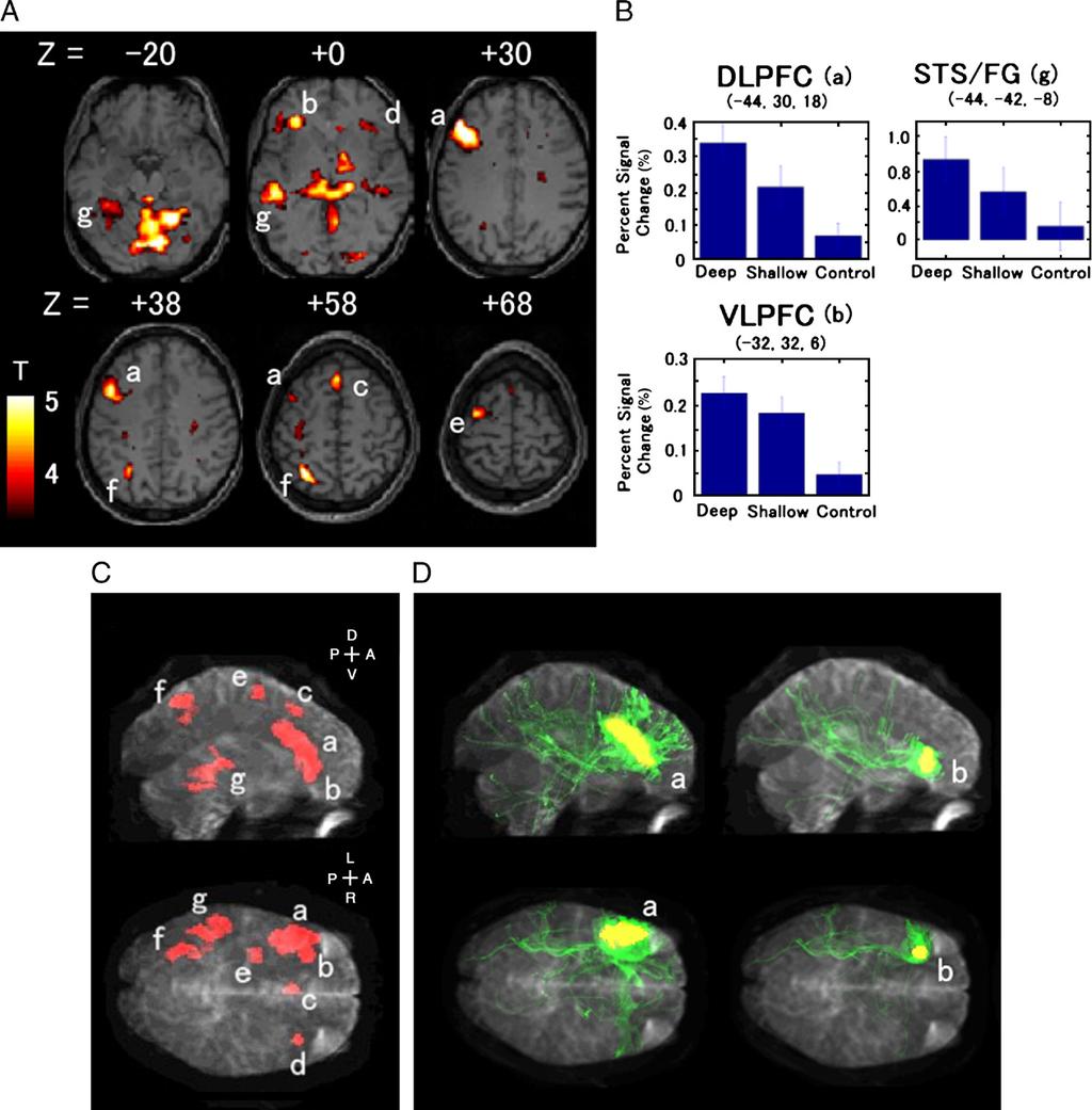 E. Takahashi et al. / NeuroImage 34 (2007) 827 838 831 significantly lower than the connectivity between DLPFC and temporal cortex activation.