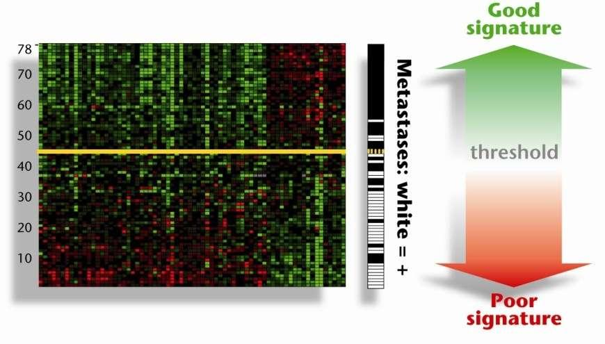 Tumor samples MammaPrint prognosis Profile the 70 gene profile 70 significant prognosis genes van t Veer