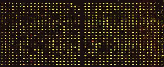 Personalized medicine: multiple answers on a single microarray chip Prognosis?