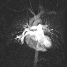Accurate imaging of the coronary arteries is crucial to the diagnosis and treatment of patients with coronary artery disease (CAD) (Figure 41).