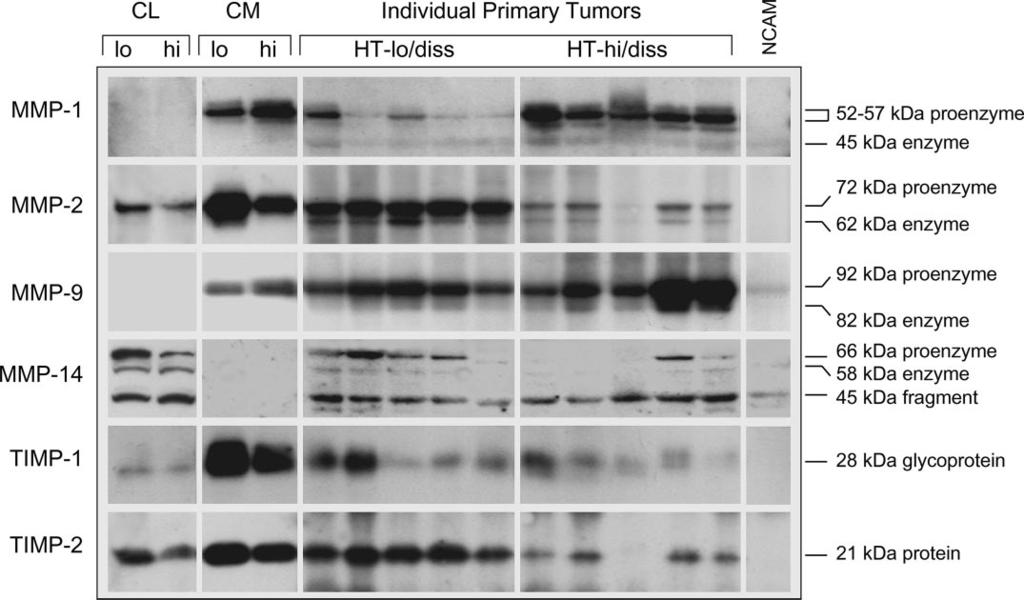 FIGURE 2. Western blot analysis of cell lysates (CL), conditioned media (CM), and lysates from individual CAM tumors generated by HT-lo/diss (lo) and HT-hi/diss (hi) cells.