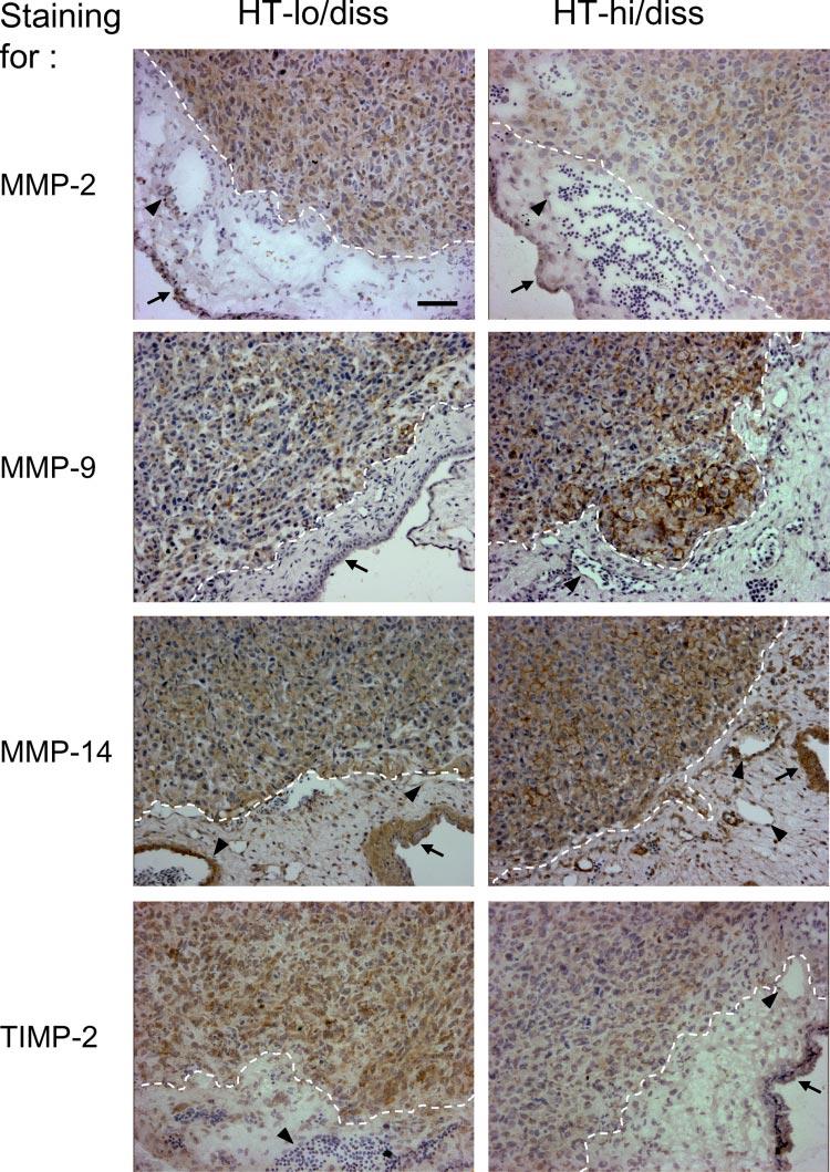 FIGURE 3. Immunohistochemical analysis of individual human MMPs and TIMP-2 in HT-lo/diss and HT-hi/ diss tumors. HT-lo/diss and HT-hi/diss cells were grafted on the CAM of the chick embryos.