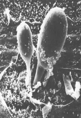Protozoa 4