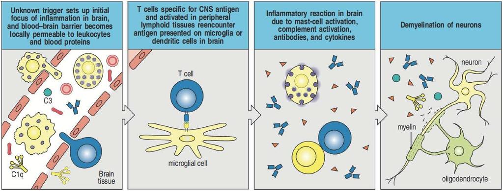 T cells Multiple sclerosis autoreactive B cells produce with help of T cells autoantibodies
