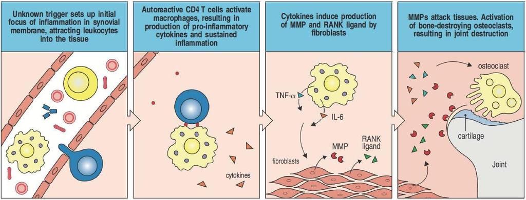T cells Rheumatoid arthritis progressive chronic disease affected tissues: