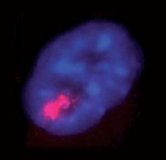 " The non-coding RNA Xist (red) coats one of the two X chromosomes in females,
