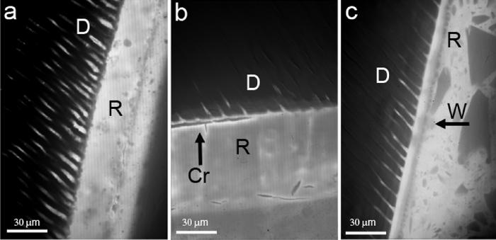 Scanning electron micrographs of the opposing ends of a fractured beam from the i-bond 1-Year storage dentin group. A mixed adhesive/cohesive failure mode is evident.