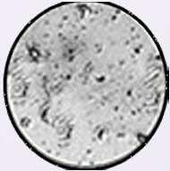 Transitional: Small ferning or crystal patterns appear among the dots and lines. Ovulation may occur in 3-4 days.