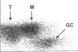 Cornfield et al / ANAYSIS OF BC-2 IN YMPHOMA AND HYPERPASIA A B 1 4 1 4 1 3 T M 1 3 T bcl-2 1 2 bcl-2 1 2 GC 1 1 1 1 1 1 1 2 1 3 1 4 1 1 1 2 1 3 1 4 Figure 1 Correlated analysis of surface and