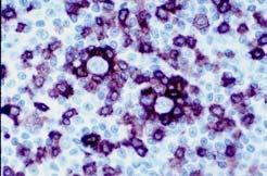 Prolymphocytes small, medium and large cells with single centrally located