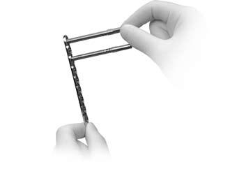 Zimmer Small Fragment Universal Locking System Surgical Technique Required instrumentation.5mm Zimmer Universal Locking System Set or.
