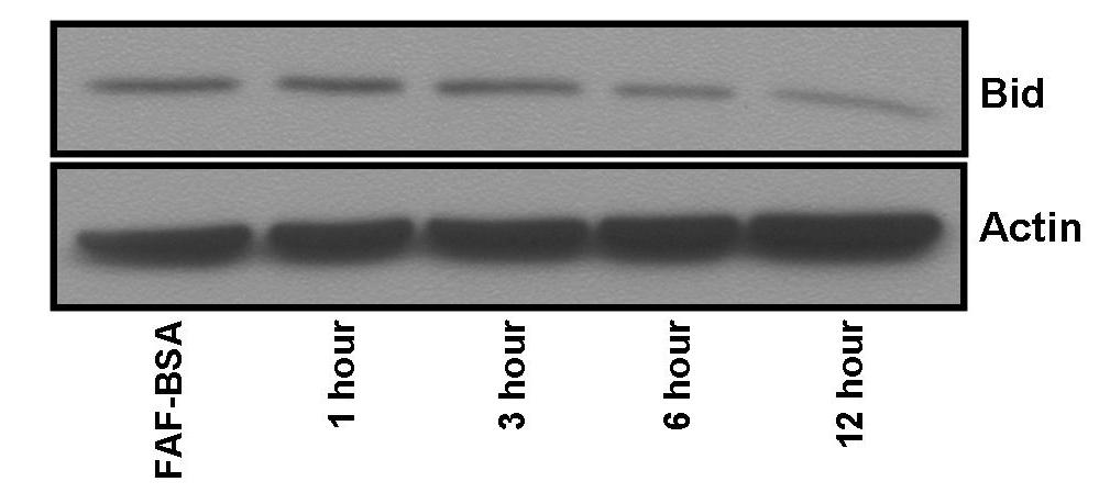 Figure 4-3: Stearate Causes a Decrease in Total Bid. Cells were plated and serum starved prior to treatment with 50 M stearate.