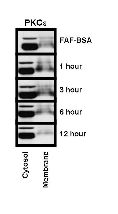 Figure A-3: Stearate Induces Translocation of PKC to the Plasma Membrane. Cells were serum starved for 24 hours prior to treatment with 50 M stearate for the times indicated.