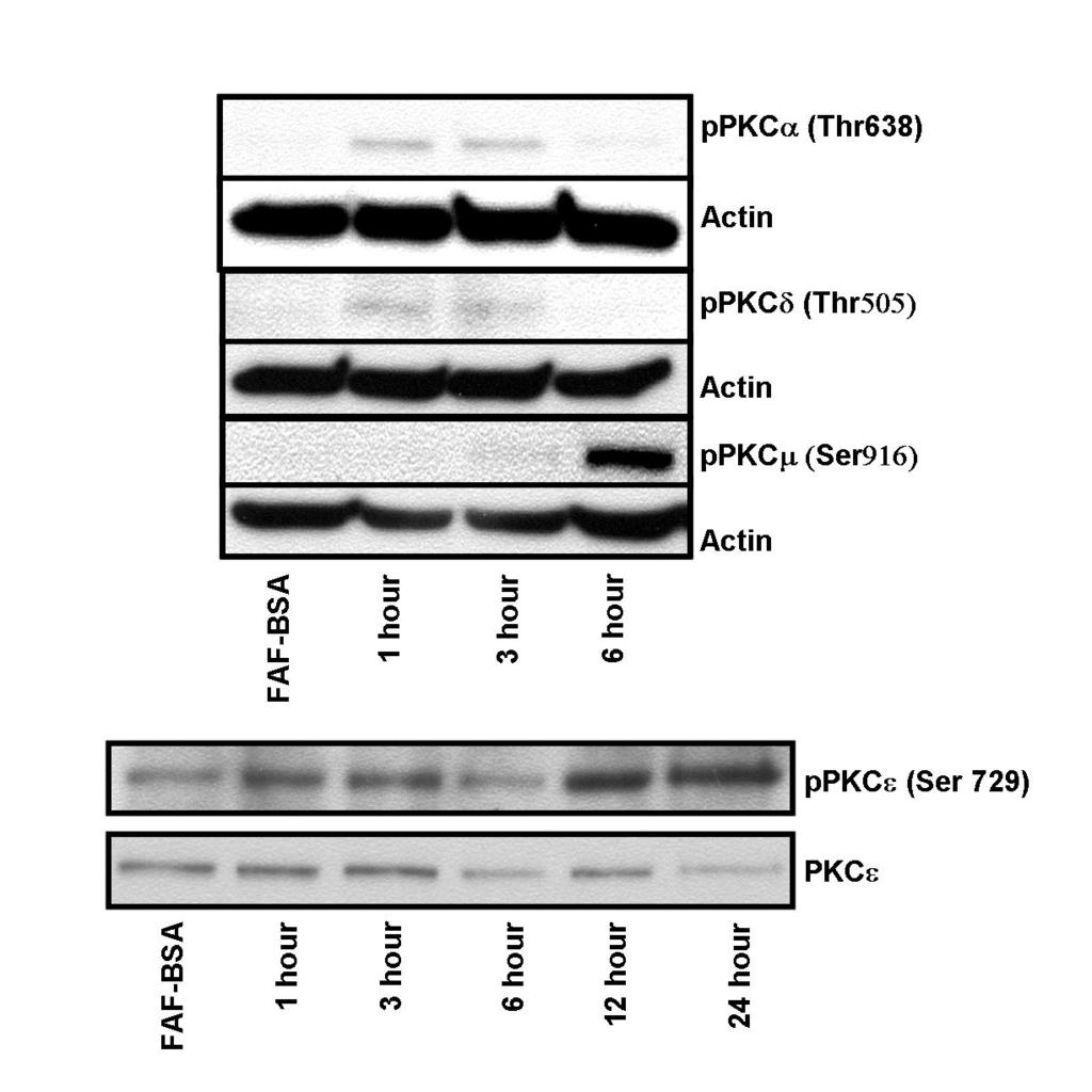 Figure 2-4: Stearate Induces Phosphorylation of Multiple Novel and Classical PKC Isozymes. Hs578t cells were serum starved for 24 hours prior to treatment with 50 M stearate for the times indicated.