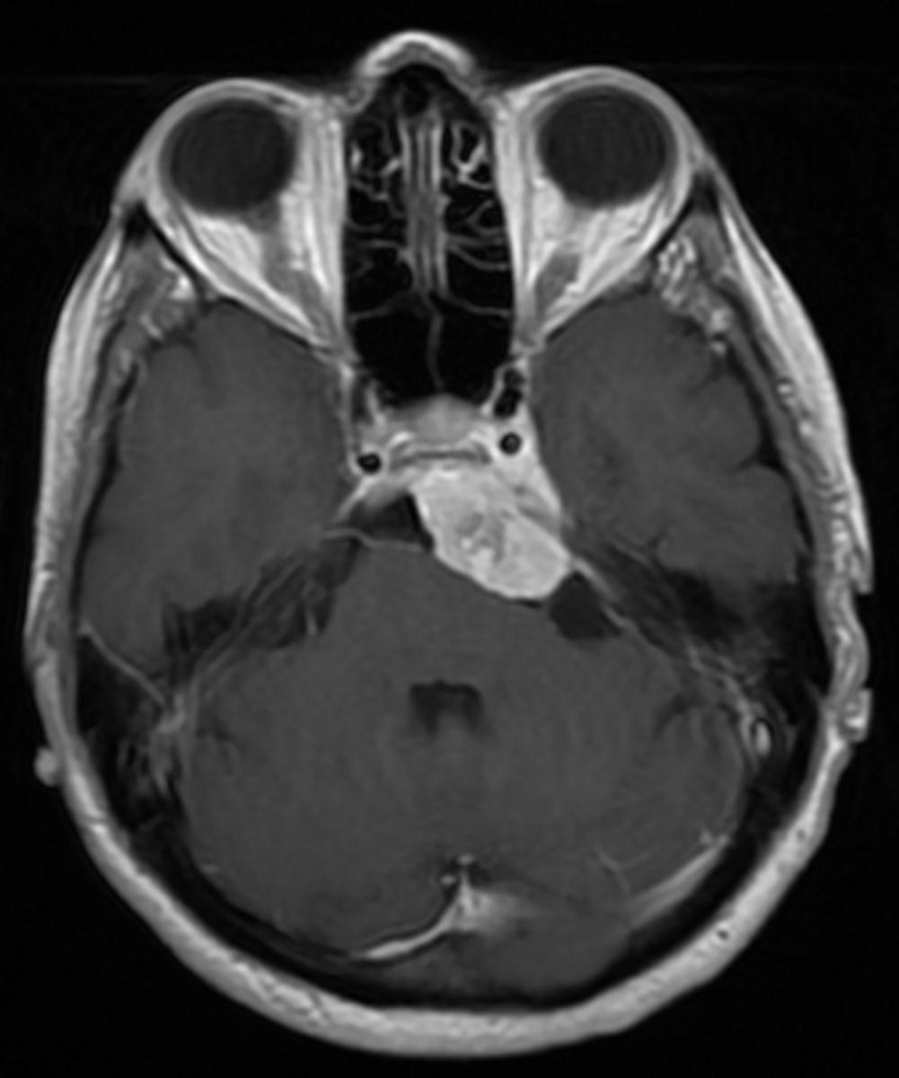 Fig. 5: Axial postcontrast T1-weighted image.