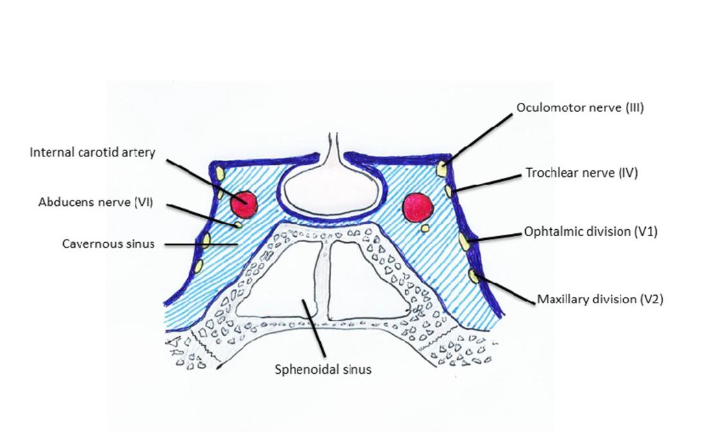 Fig. 2: Drawing of a coronal section of the cavernous sinuses.