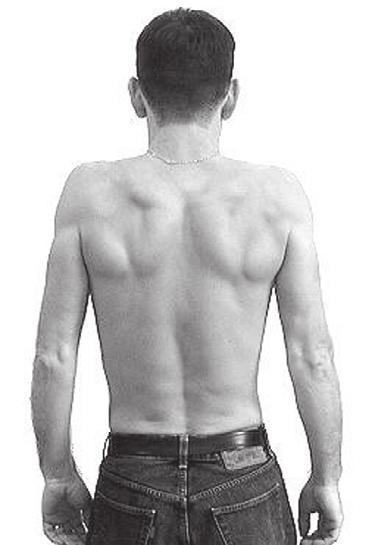 The Girdle Active protraction of both shoulders The patient brings both shoulders forwards. The normal range of scapular abduction is about 30.