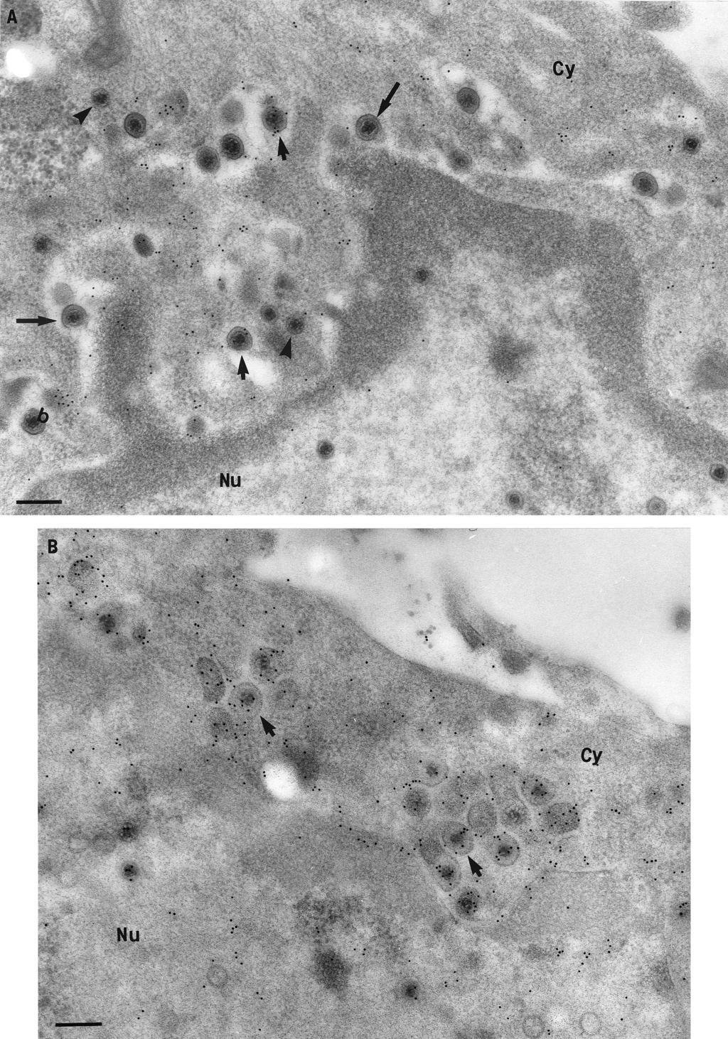 FIG. 9. Immunogold labeling for tegument proteins of HSV-1-infected neurons treated with BFA.