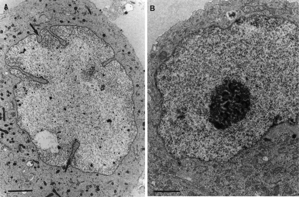 9936 MIRANDA-SAKSENA ET AL. J. VIROL. FIG. 1. Ultrastructural changes in the nucleus of HSV-1-infected neurons.