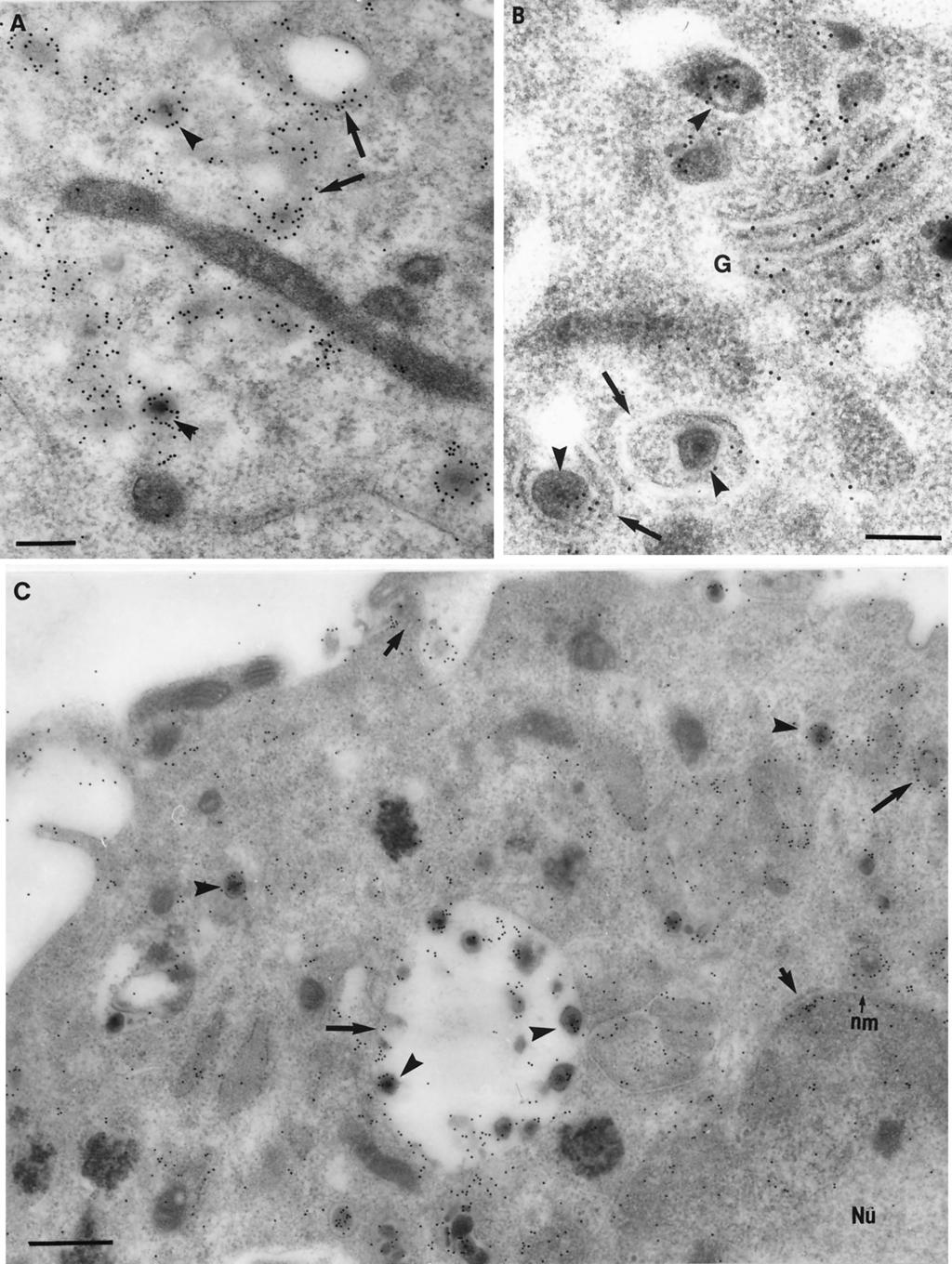 FIG. 4. Immunolabeling of tegument proteins and glycoproteins on viral particles and cytoplasmic membranes in HSV-1-infected neurons.