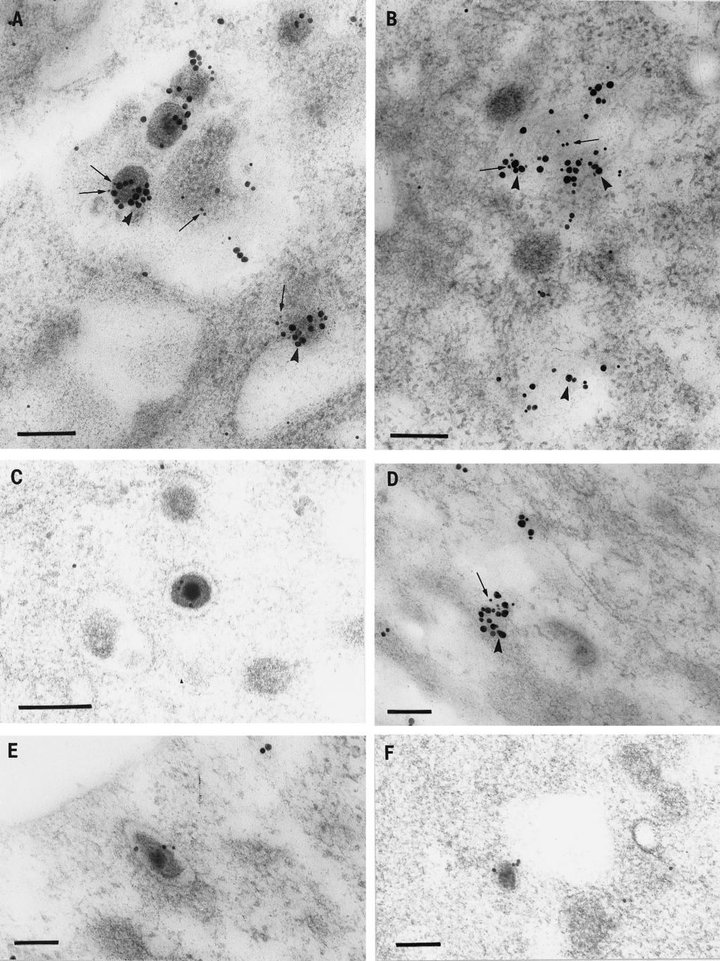 9942 MIRANDA-SAKSENA ET AL. J. VIROL. FIG. 6. Immunogold labeling of HSV-1-infected neurons for tegument proteins and Golgi markers.