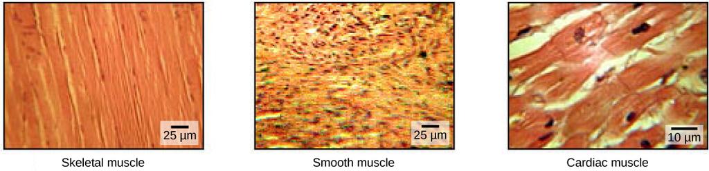 OpenStax-CNX module: m62980 3 Figure 1: The body contains three types of muscle tissue: skeletal muscle, smooth muscle, and cardiac muscle, visualized here using light microscopy.